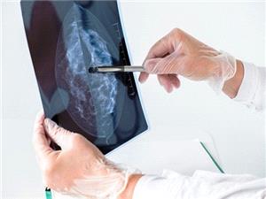 ضرورت آزمايش ماموگرافي براي زنان بالاي 40 سال