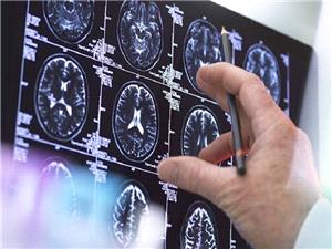 اکتشاف روسی یسرع ابتکار علاجات فعاله لأکثر أنواع أورام الدماغ عدوانیه